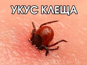Укус клеща